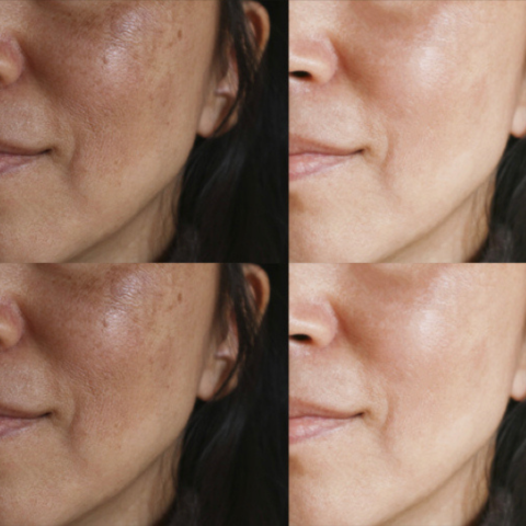 Sérum Maxxia® Peeling Facial