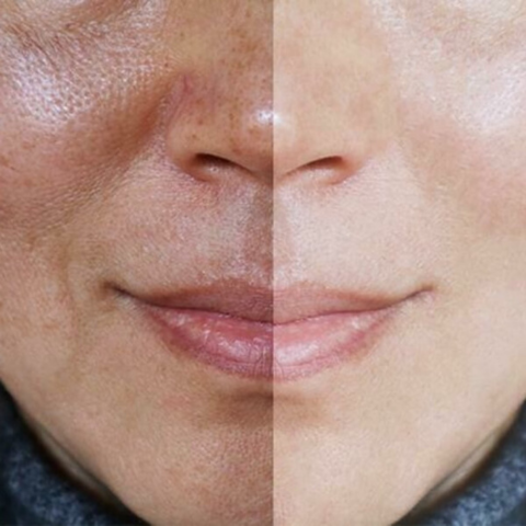 Sérum Maxxia® Peeling Facial