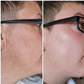 Sérum Maxxia® Peeling Facial