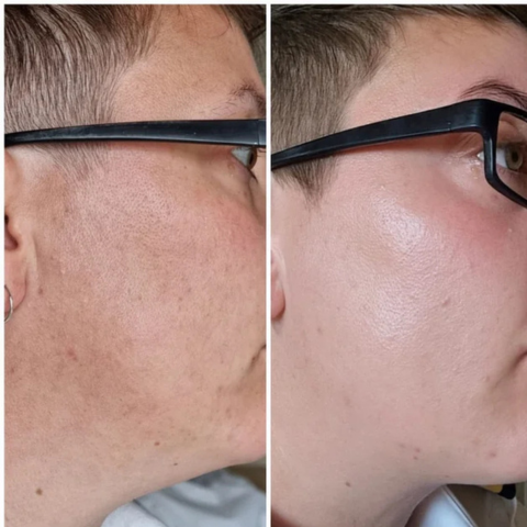 Sérum Maxxia® Peeling Facial