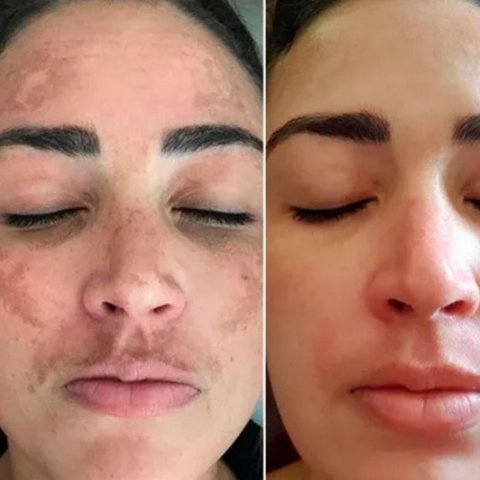 Sérum Maxxia® Peeling Facial