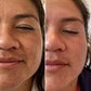 Sérum Maxxia® Peeling Facial