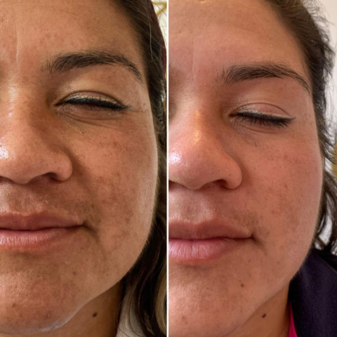 Sérum Maxxia® Peeling Facial